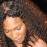 Serena hair loss fight