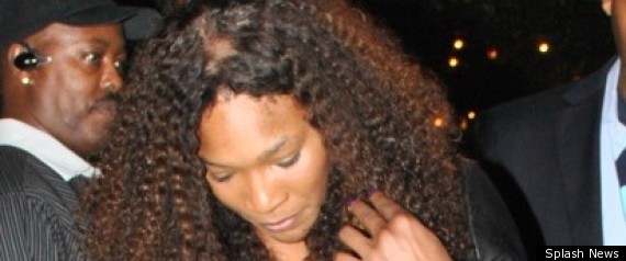 Serena hair loss fight